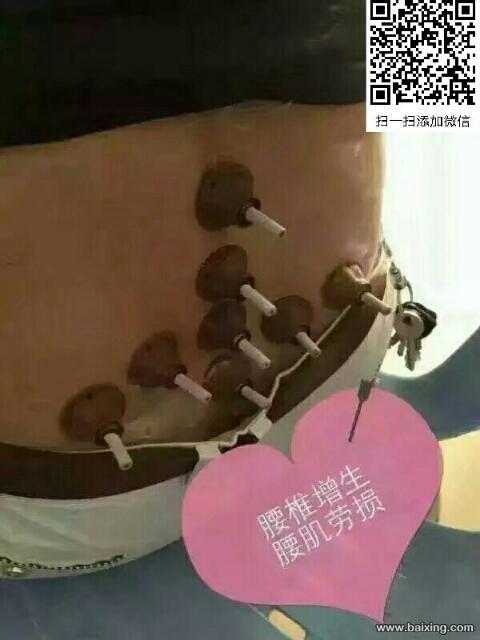 克孜勒苏 乌恰 艾艾贴招募合作伙伴