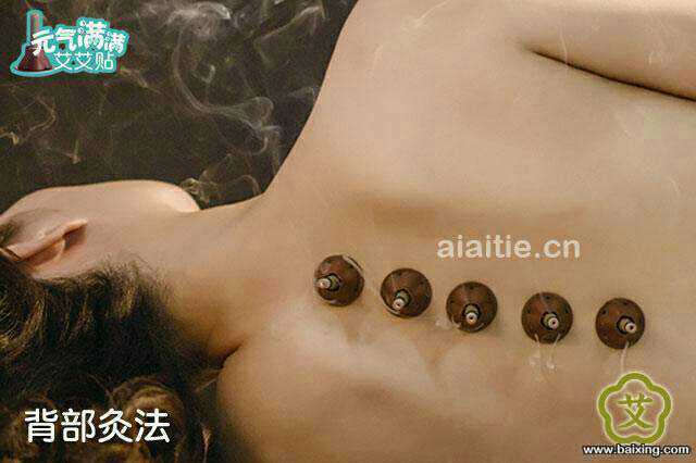 克孜勒苏微商养生爆款艾艾贴如何代理?在哪购买? 多