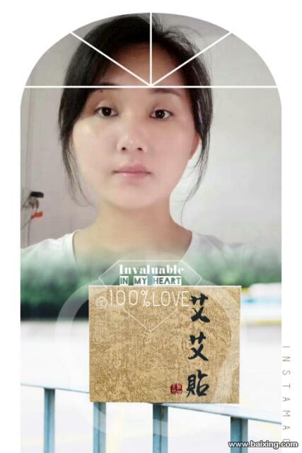 克孜勒苏微商养生爆款艾艾贴如何代理?在哪购买? 多